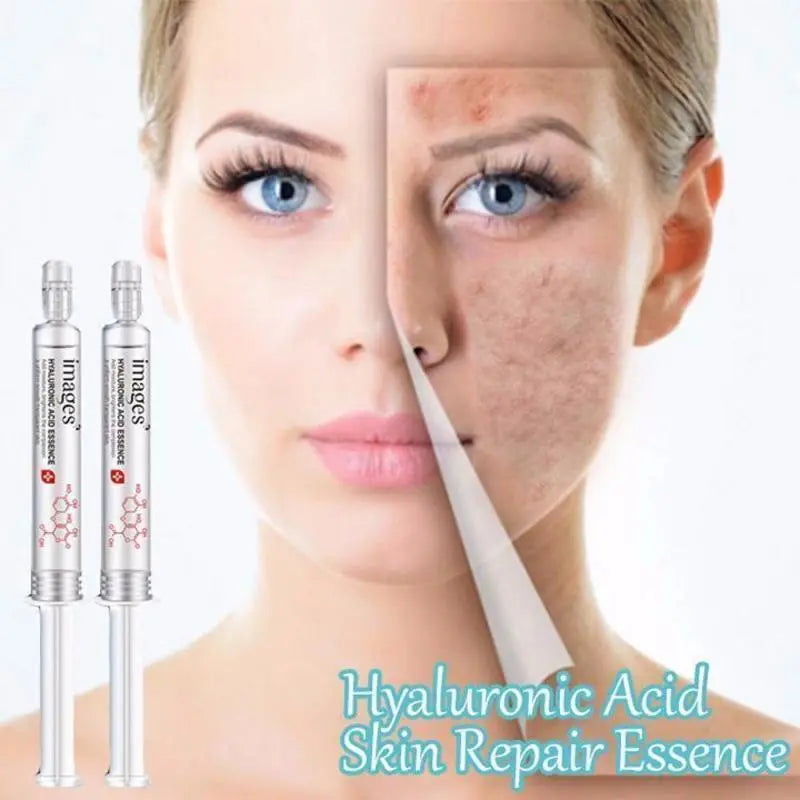 Image Beauty Hyaluronic Acid Moisturizing: The Ultimate Hydration Secret