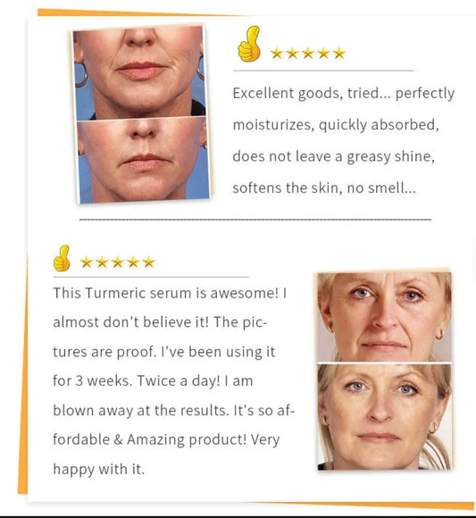 Beauty Lights Turmeric Serum Prime Mart