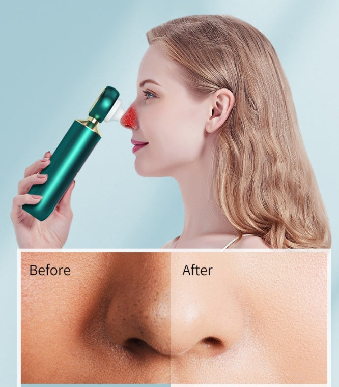 Portable Blackhead Remover | USB, Magnifying Glass, Blue Light, Pore Cleaner