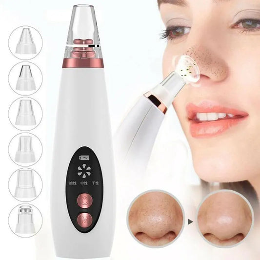 Blackhead & Acne Remover Suction Device – Prime Mart Prime Mart